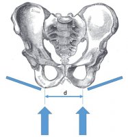 PelvicBone.jpg